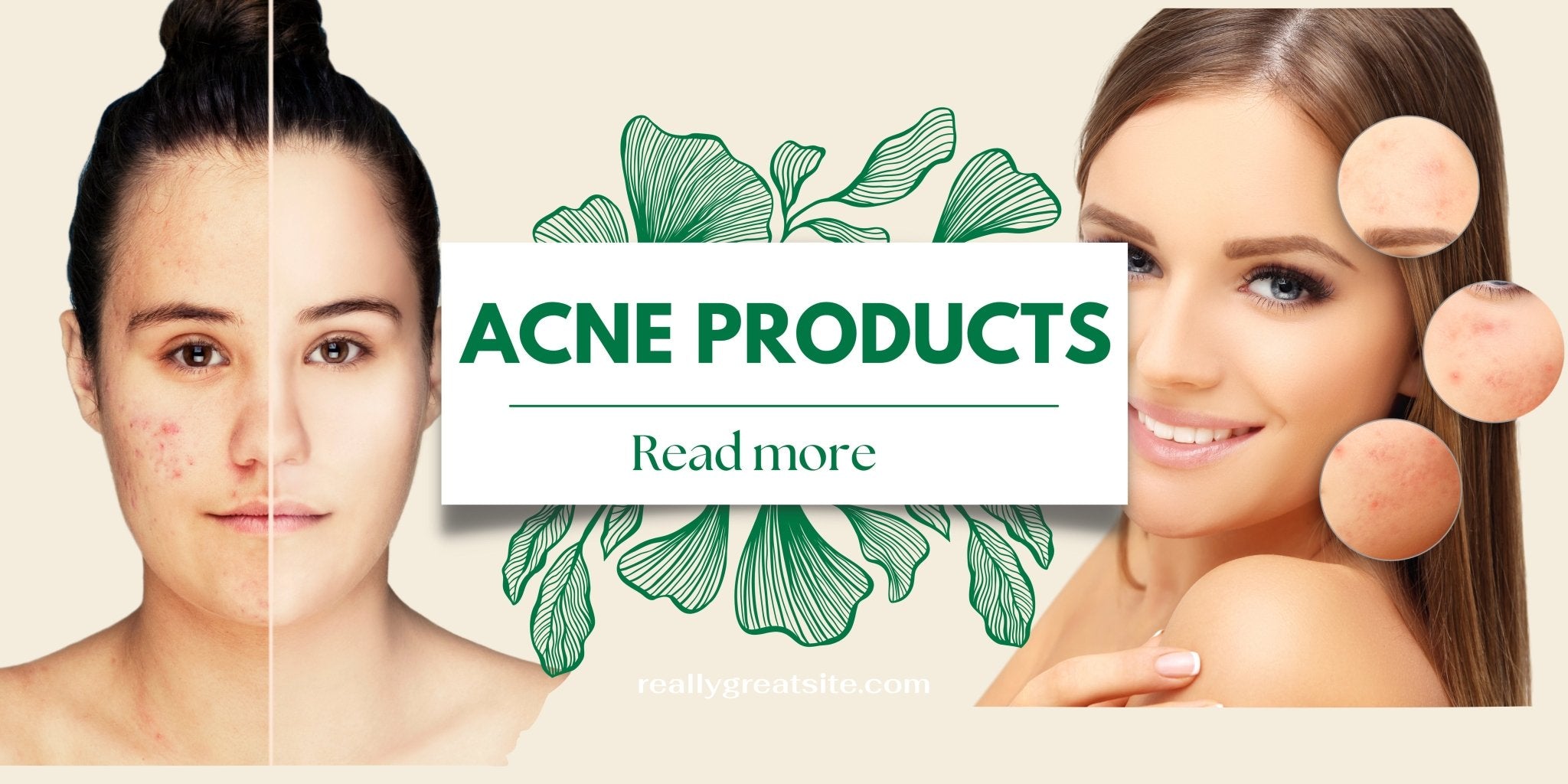 Achieve Flawless Skin with Our 4PCS Acne, Blackhead, Blemish Remover Kit and More - Ammpoure