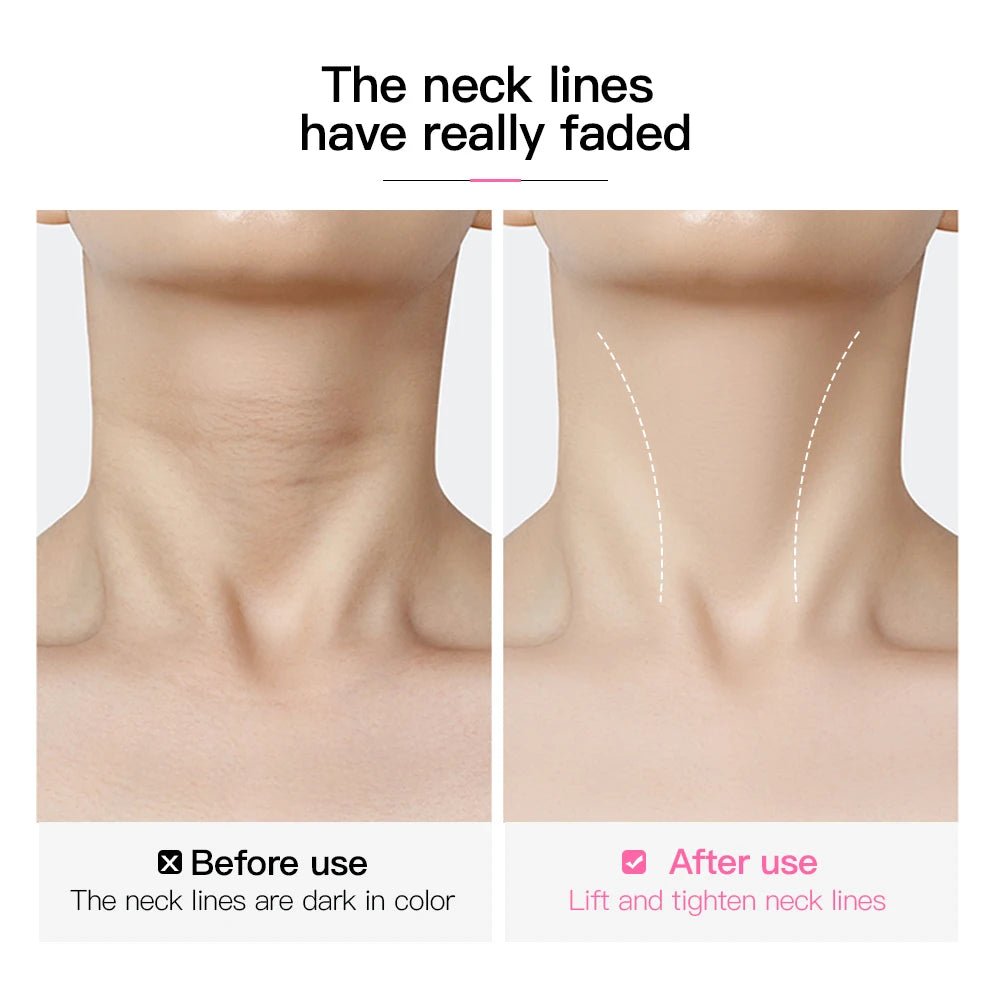 10pcs Transparent Neck Lifting Patches Waterproof Elasticity Invisible Fading Neck Wrinkle Adhesive Stickers Face Lift Tape - Ammpoure
