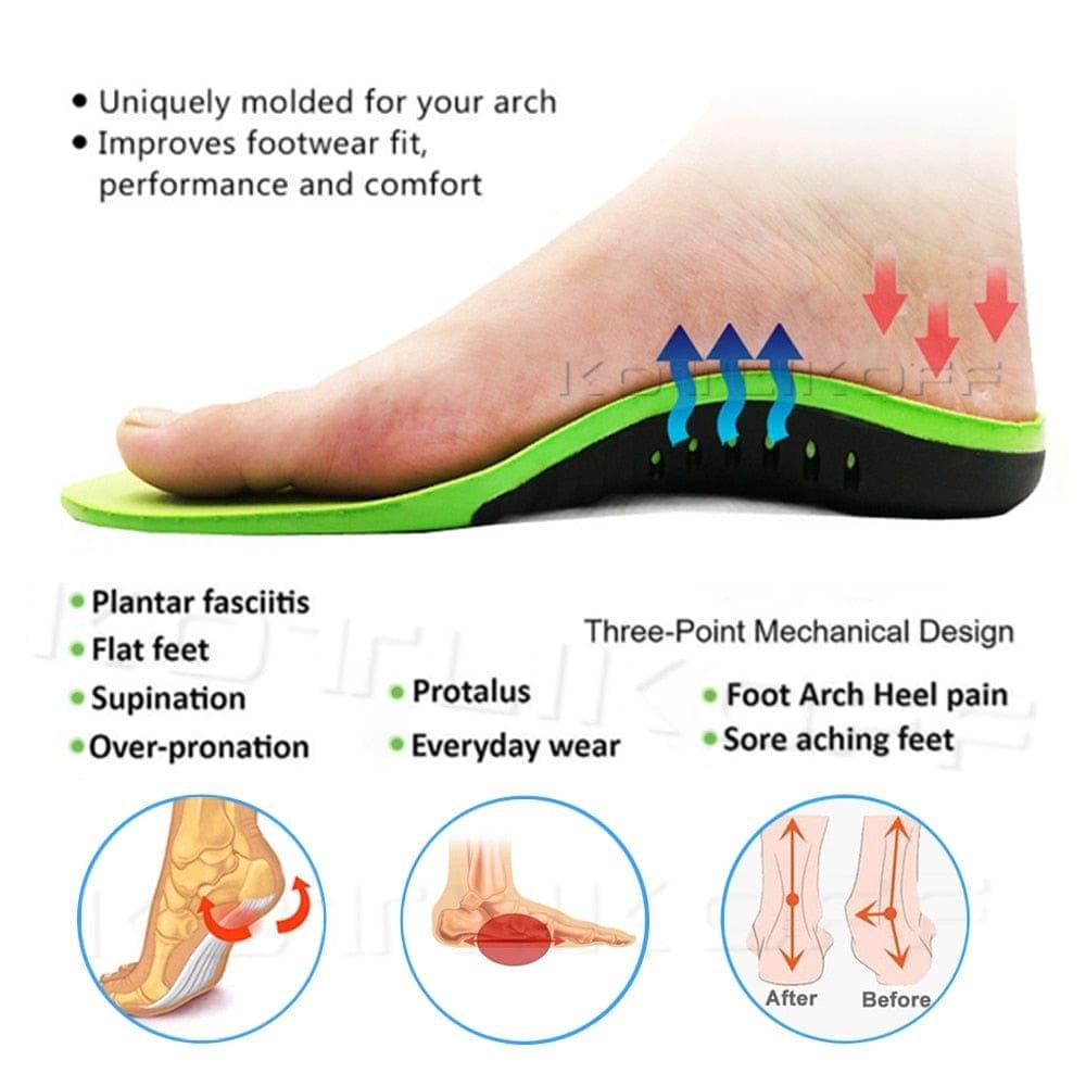 Best Orthopedic Shoes Sole Insoles UK For Shoes Arch Foot Pad X/O Type Leg Correction Flat Foot Arch Support Sports Shoes Inserts - Ammpoure Wellbeing