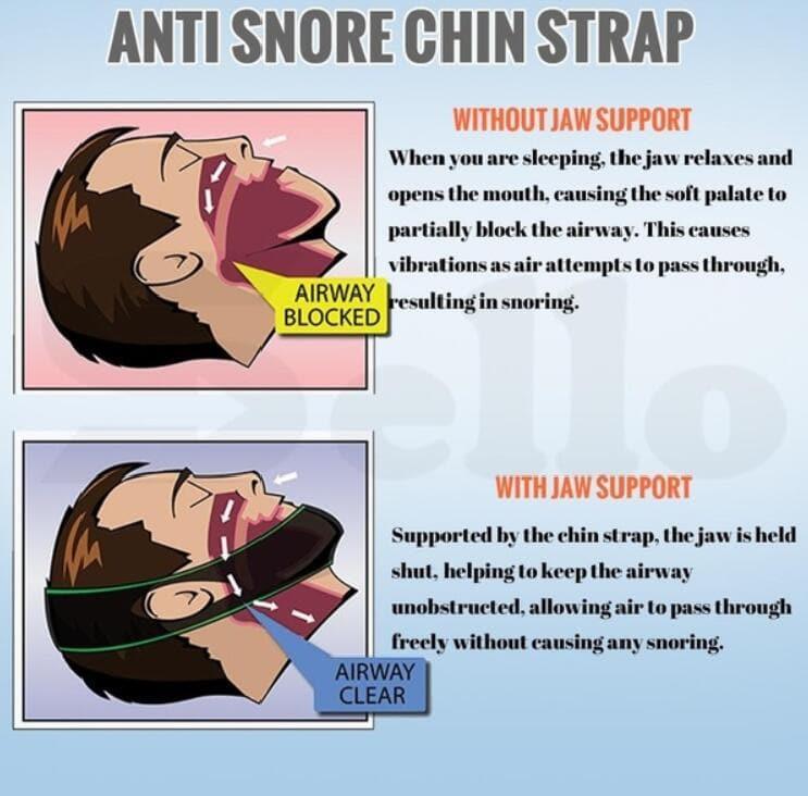 Deals: Anti Snore Wristband, Anti Snoring Devices+ Anti Snoring Chin Strap Belt Uk - Ammpoure