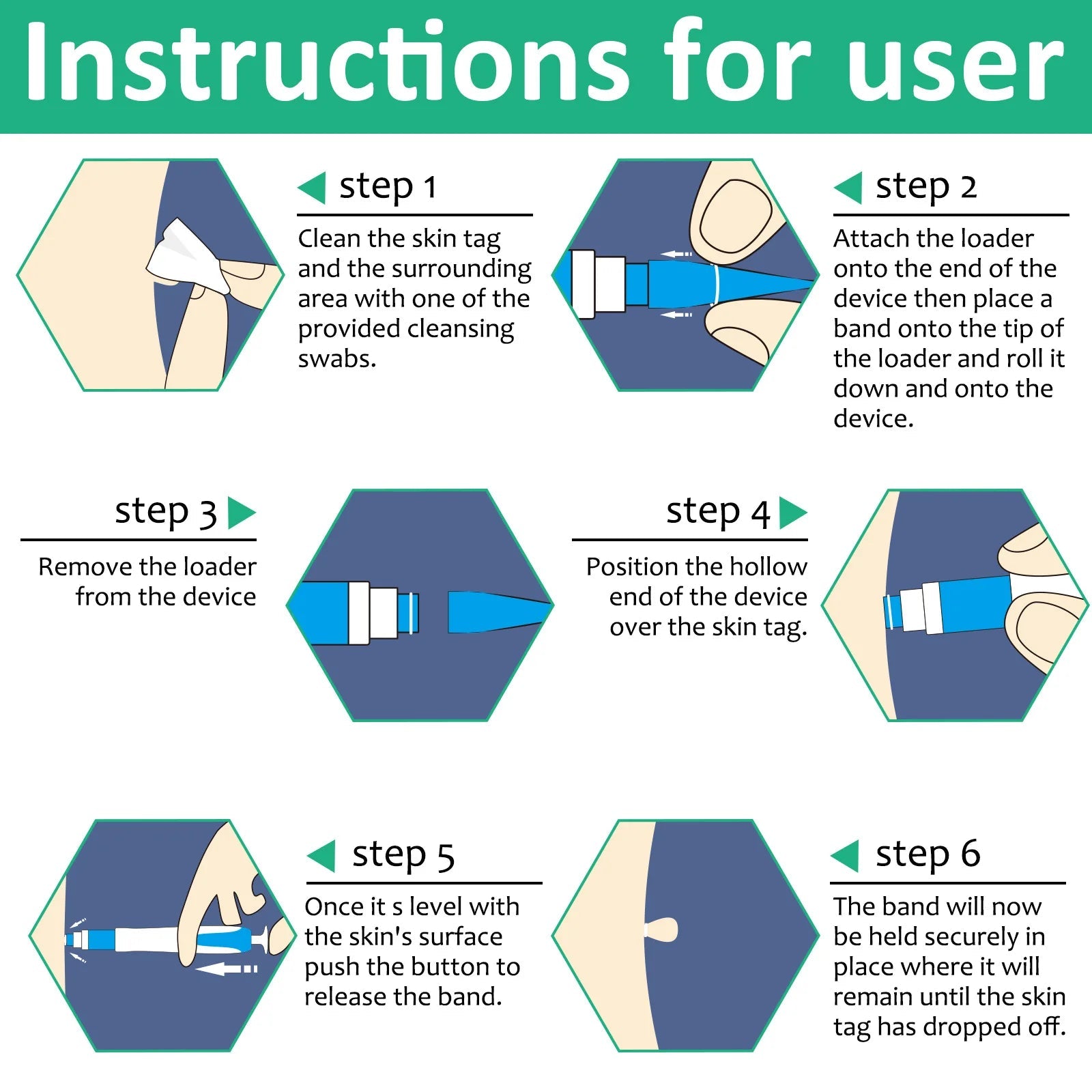 Home Use Painless Safe Skin Tag Mole Wart Spot Removal Equipment for Smooth Skin Wart Remover Eyelid Lifting Acne Treatment Pen - Ammpoure