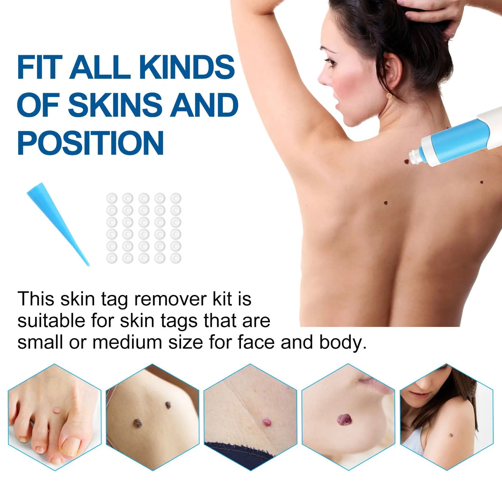 Home Use Painless Safe Skin Tag Mole Wart Spot Removal Equipment for Smooth Skin Wart Remover Eyelid Lifting Acne Treatment Pen - Ammpoure