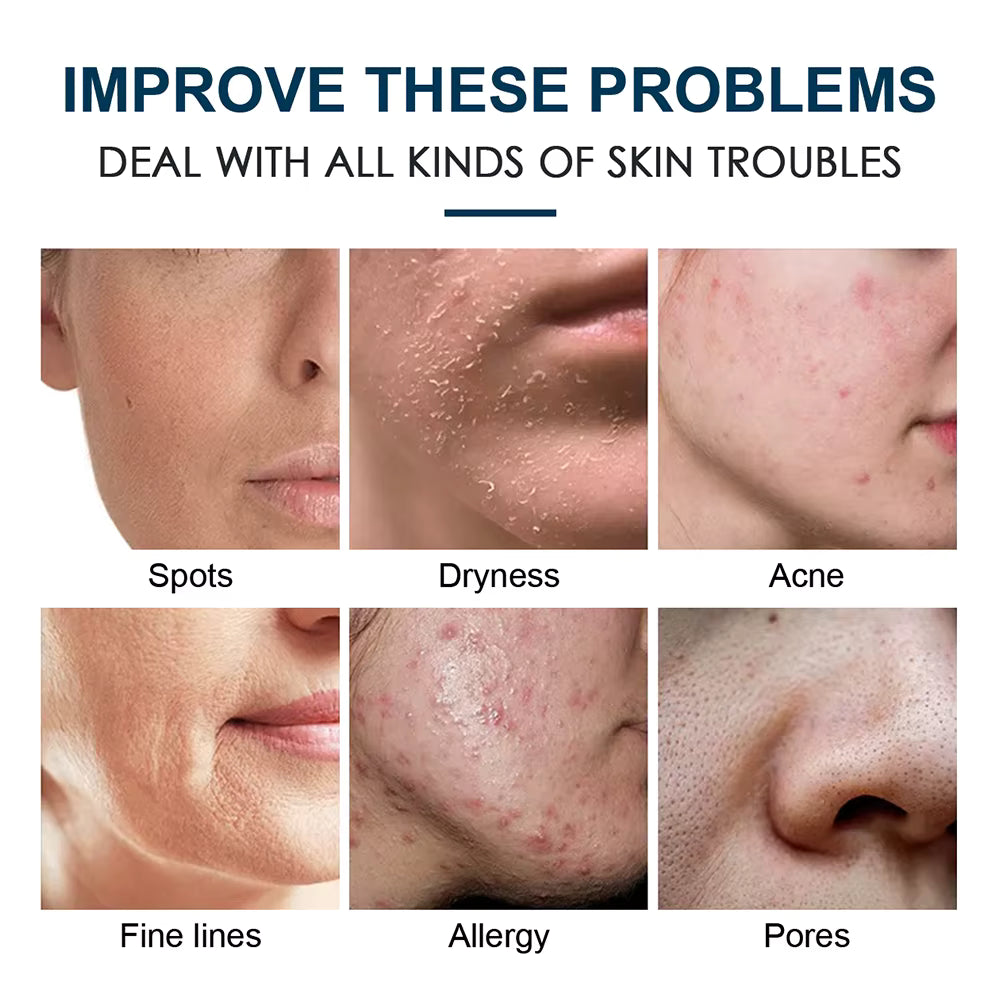 Pack of 30 Masks- Brightening (Pack of 10) + Whitening (Pack of 10) + Anti Ageing (Pack of 10)