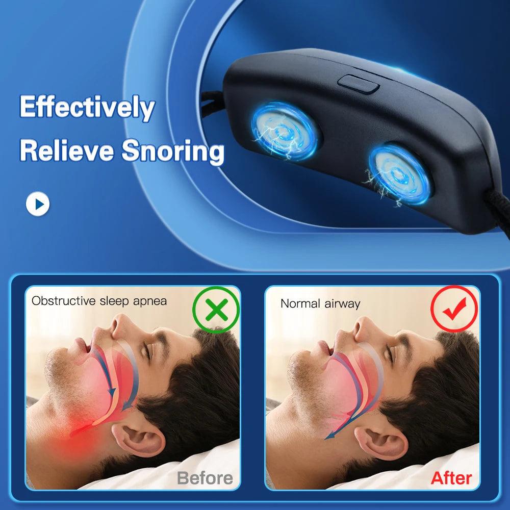 Smart Anti Snoring Device UK EMS Pulse Stop Snore Portable Comfortable Sleep Well Stop Snore Health Care Sleep Apnea Aid USB - Ammpoure Wellbeing