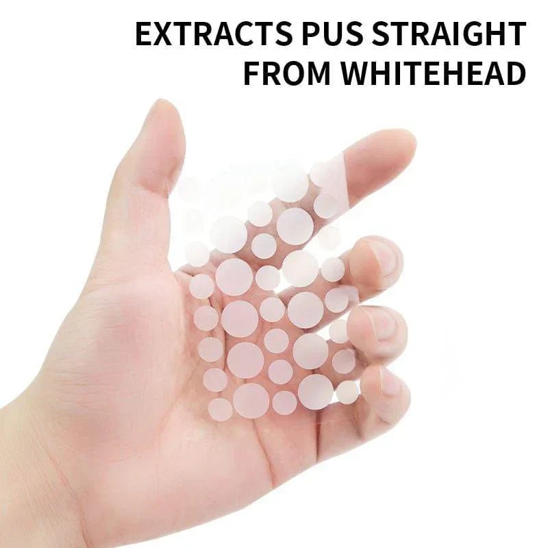 How to Use Pimple Patches Correctly (and Why These 72 from Ammpoure Work Best) - Ammpoure Wellbeing