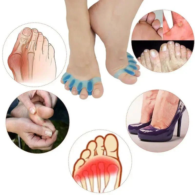 Step Into Relief – Why Toe Separators Belong in Your Daily Routine