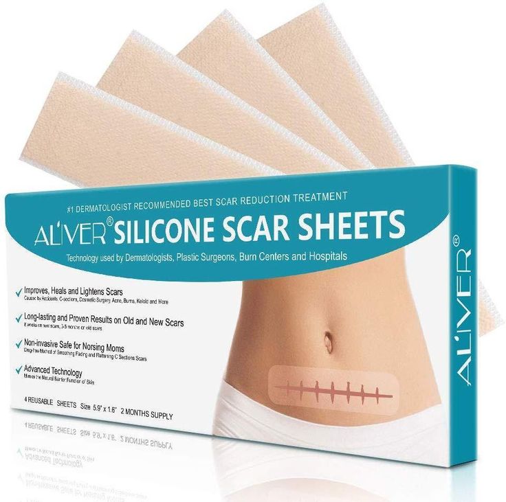 Why Silicone Scar Sheets Deserve a Spot in Your Skincare Routine