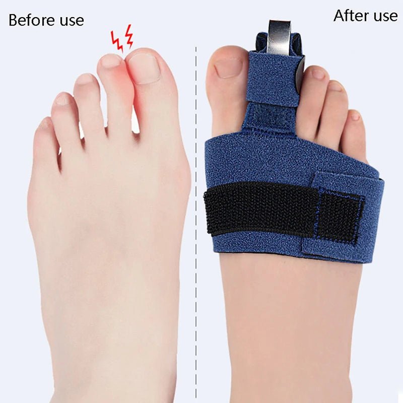 1Pc Toe Corrector Toe Fracture Fixator Orthotics Feet Bone Thumb Adjuster Correction Soft Pedicure Socks Bunion Straightener - Ammpoure