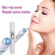 Load image into Gallery viewer, Blue Light Facial Machine Acne Wrinkle Removal Laser Pen Skin Spots Removal Anti Varicose Spider Vein Eraser Medical Treatment - Ammpoure Wellbeing 🇬🇧
