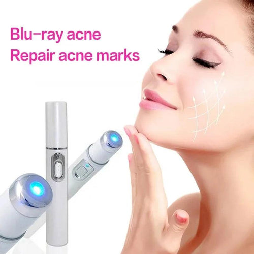 Blue Light Facial Machine Acne Wrinkle Removal Laser Pen Skin Spots Removal Anti Varicose Spider Vein Eraser Medical Treatment - Ammpoure Wellbeing 🇬🇧