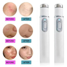 Load image into Gallery viewer, Blue Light Facial Machine Acne Wrinkle Removal Laser Pen Skin Spots Removal Anti Varicose Spider Vein Eraser Medical Treatment - Ammpoure Wellbeing 🇬🇧
