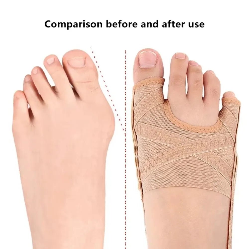 Bunion Corrector Breathable 4 Gears Adjustable Toe Valgus Corrector Comfortable Fabric Toe Orthotics Brace Men/Women - Ammpoure
