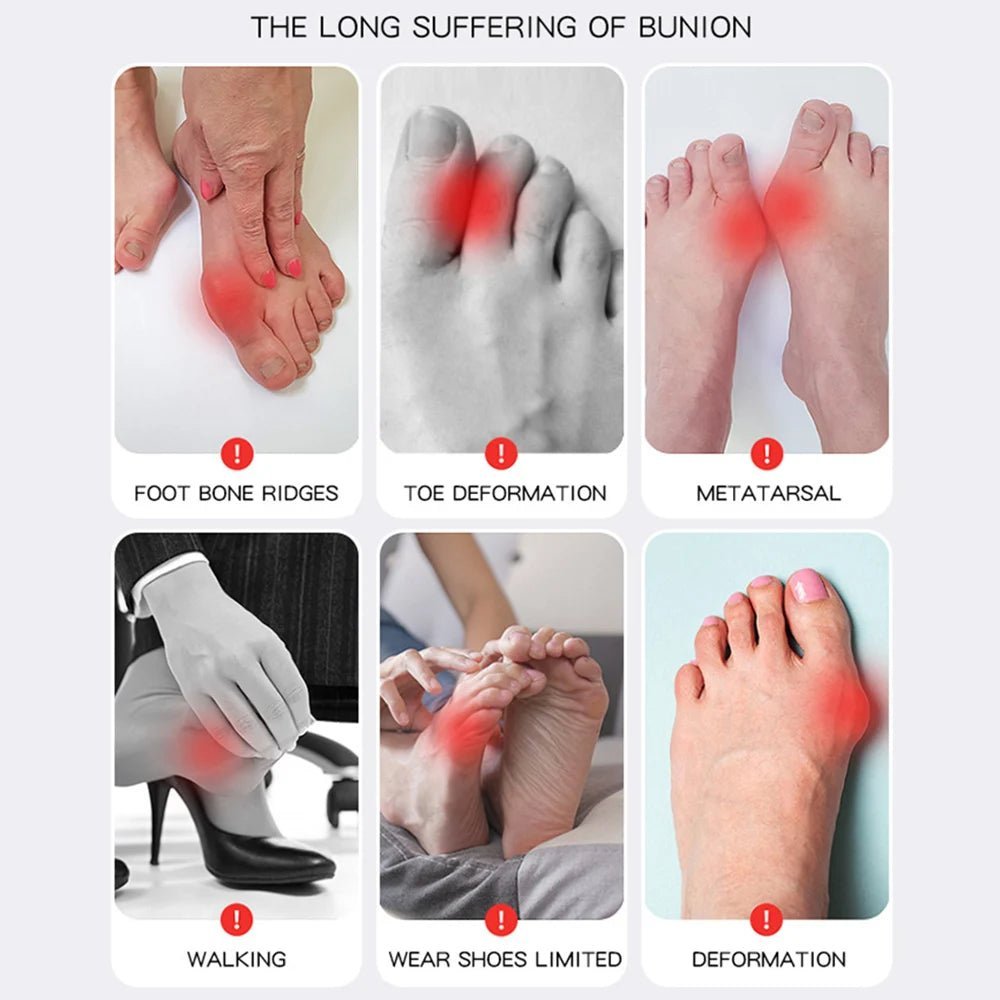 Deals: 1PC Big Toe Bunion Corrector Adjustable Orthopedic Socks Toes Separator + Bunion Splint Big Toe Straightener Corrector UK - Ammpoure