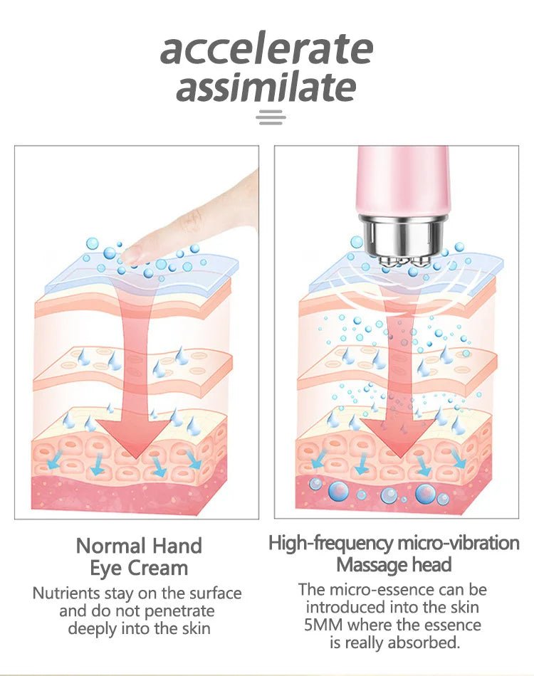 Electric Eye Massager with Micro - Vibration Tech Eye Face Beauty Relieving Eye Dark Circles Eyebags Eye Lifting Massage Device - Ammpoure