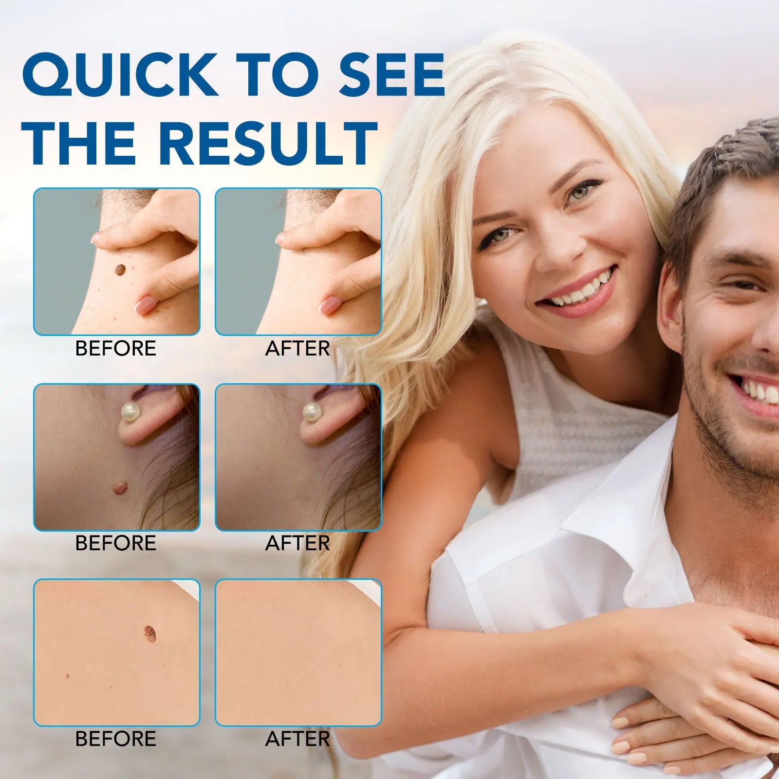 Home Use Painless Safe Skin Tag Mole Wart Spot Removal Equipment for Smooth Skin Wart Remover Eyelid Lifting Acne Treatment Pen - Ammpoure