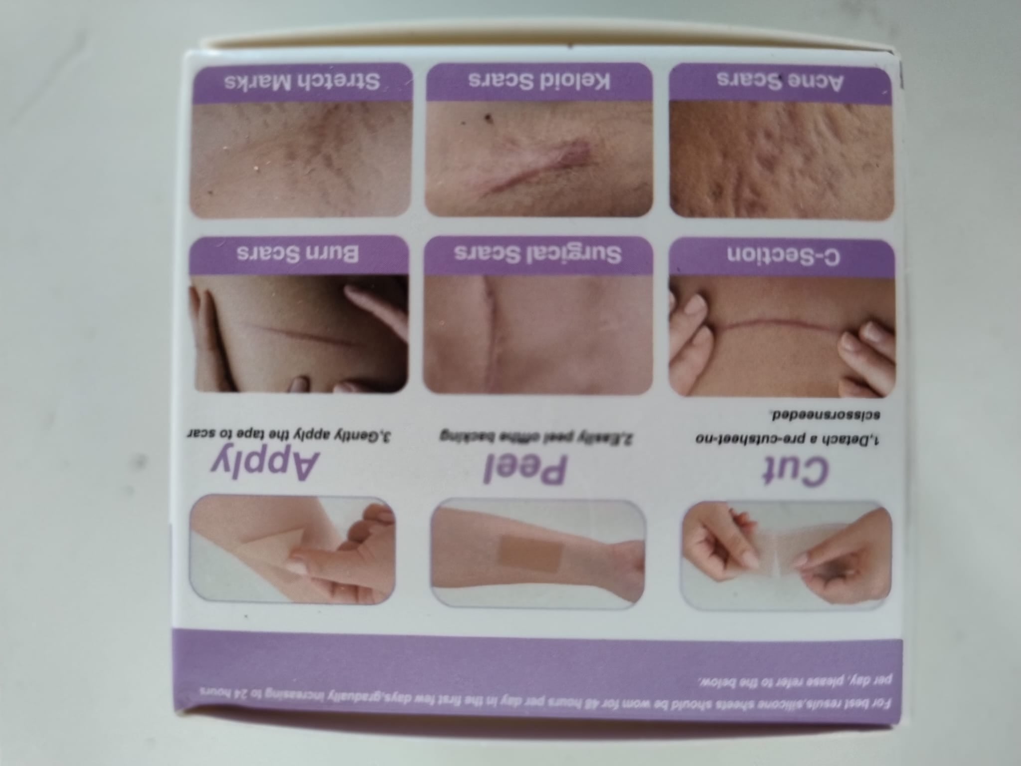 Silicone Scar Sheets UK - Roll / Strip - Ammpoure