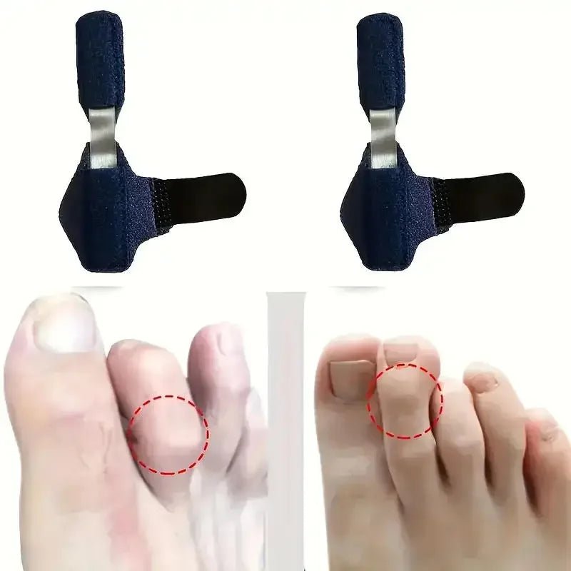 Toe Splint Straightener For Hammer Toe Corrector Crooked Toe Claw Toe Stabilizer Support Brace Wrap Pain Relief Kids Adults - Ammpoure
