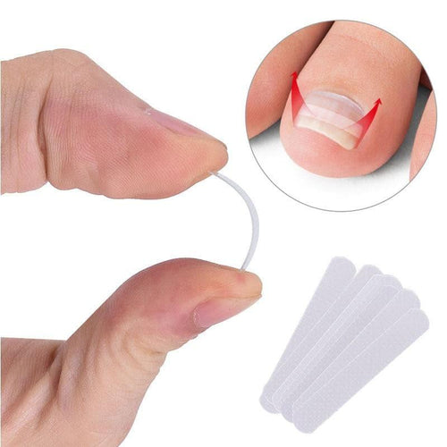 10pcs Ingrown Toenail Correction Patch Sticker - Ammpoure Wellbeing 🇬🇧