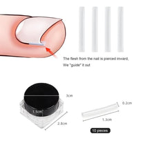Load image into Gallery viewer, 10pcs Ingrown Toenail Correction Patch Sticker - Ammpoure Wellbeing 🇬🇧
