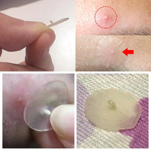 Load image into Gallery viewer, 72 Pimple Acne Patches - Ammpoure London
